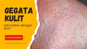 Nak Ke Klinik Resdung? Pastikan Resdung Anda Bukan Sebab Saka 57 ubat gatal kulit, gatal kulit, ubat gatal,krim gatal, cara hilang gatal badan, gatal gatal badan,ubat sapu gatal,ubat gatal badan,punca gegata waktu malam, alergi gatal kulit, gatal tapak kaki, gatal badan, krim gatal kulit, penyakit gatal kulit, punca gegata, gegata kulit, gagal-gatal kulit,punca gatal badan, cara hilangkan gatal dimuka, petua hilangkan gatal kulit.