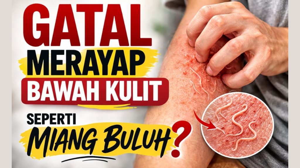 Gatal Merayap Bawah Kulit? 1 Gatal Merayap Bawah Kulit Seperti Miang Buluh